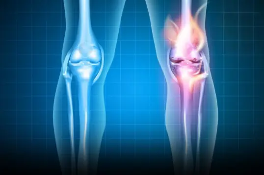 Bone Health Alert: 6 Foods That May Lower Calcium Levels