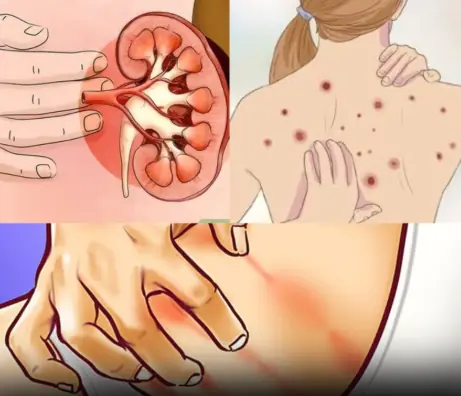 Recognizing Kidney Problems: 10 Symptoms to Watch For