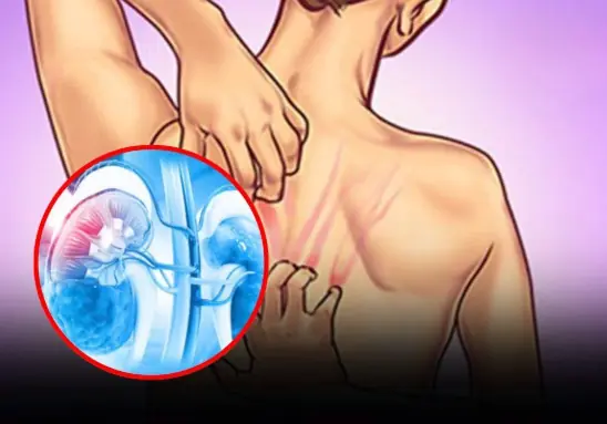 Pay Attention: 10 Signs Your Kidneys May Not Be Functioning Properly