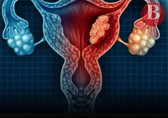 3 Overlooked Intimate Habits That May Contribute to Cervical Cancer Risk