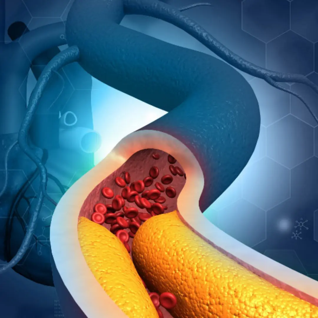 Managing High Blood Pressure and Cholesterol? Don’t Do These 3 Things After Waking Up