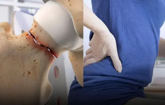 Osteoporosis: The Hidden Condition That Can Change Your Life