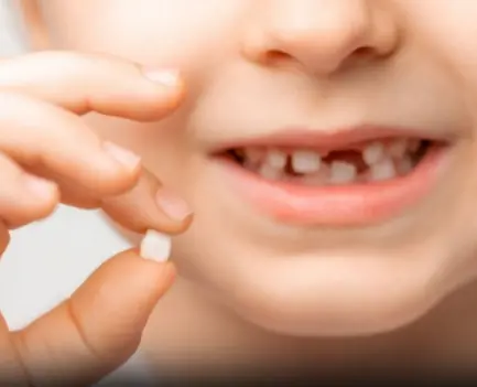 Holding On to Baby Teeth? Here’s Why Some Experts Say You Should