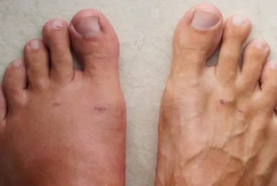 Doctors Warn: 7 Red Flags Your Body May Show Before a Heart Attack