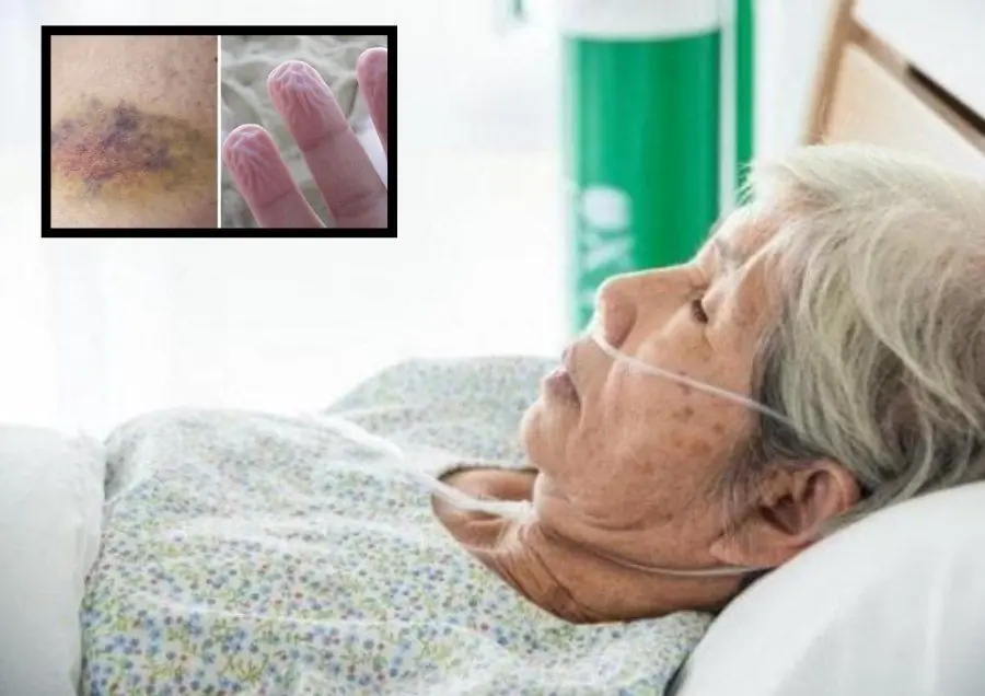 6 Warning Signs the Body May Show About a Year Before Death