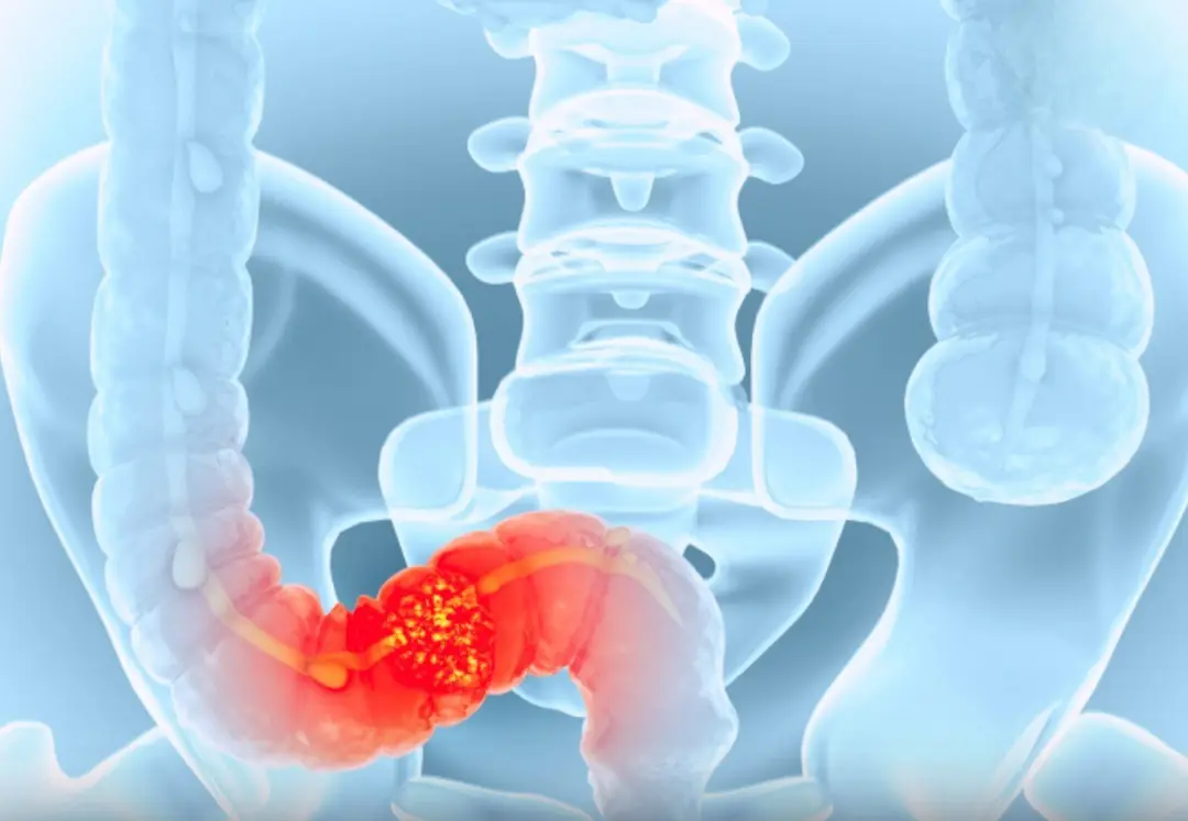 Be careful because you may have this disease