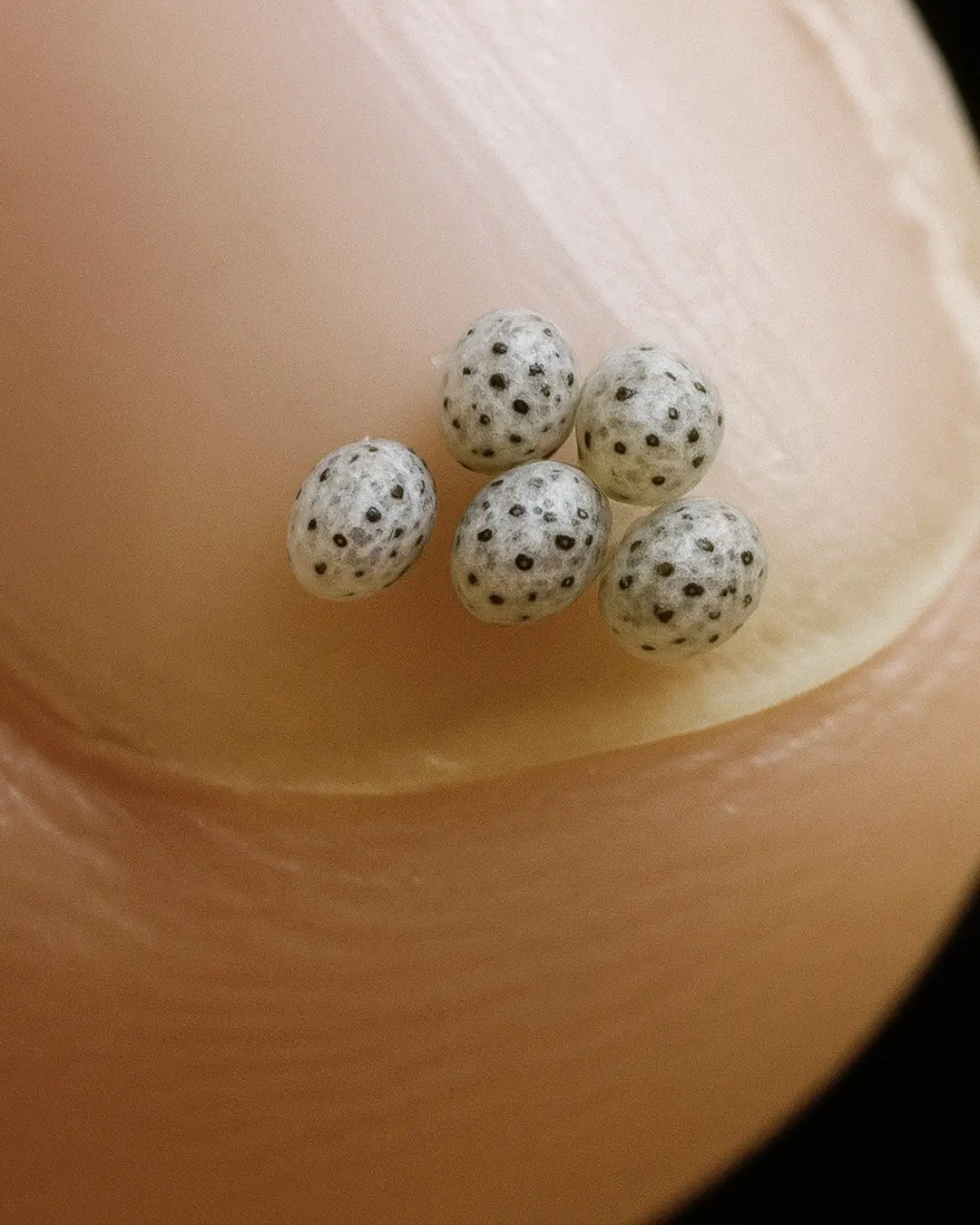 We Ordered a Salad, Found Tiny Black Specks — Then Went Straight to the Hospital