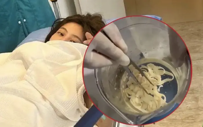 A 32-year-old woman pas.sed a LIVE 3-METER-LONG organism — doctors pointed to a common kitchen item as the hidden cause.