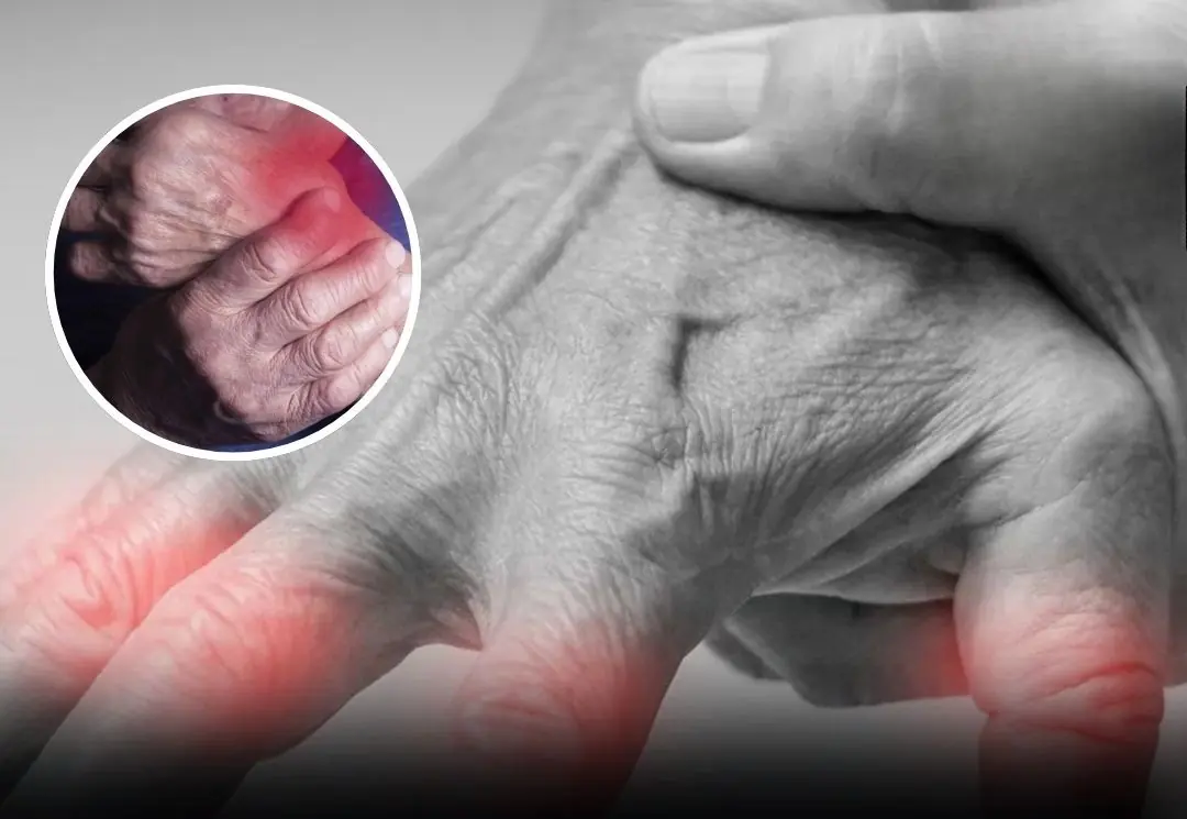 A Common Disease That Attacks From the Inside — Plus the Habit That Can Make It Worse