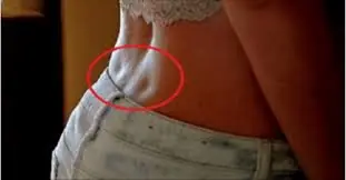 What Do Those Two Dimples on Your Lower Back Really Mean?