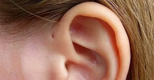 Here is what this little hole on the ear mean