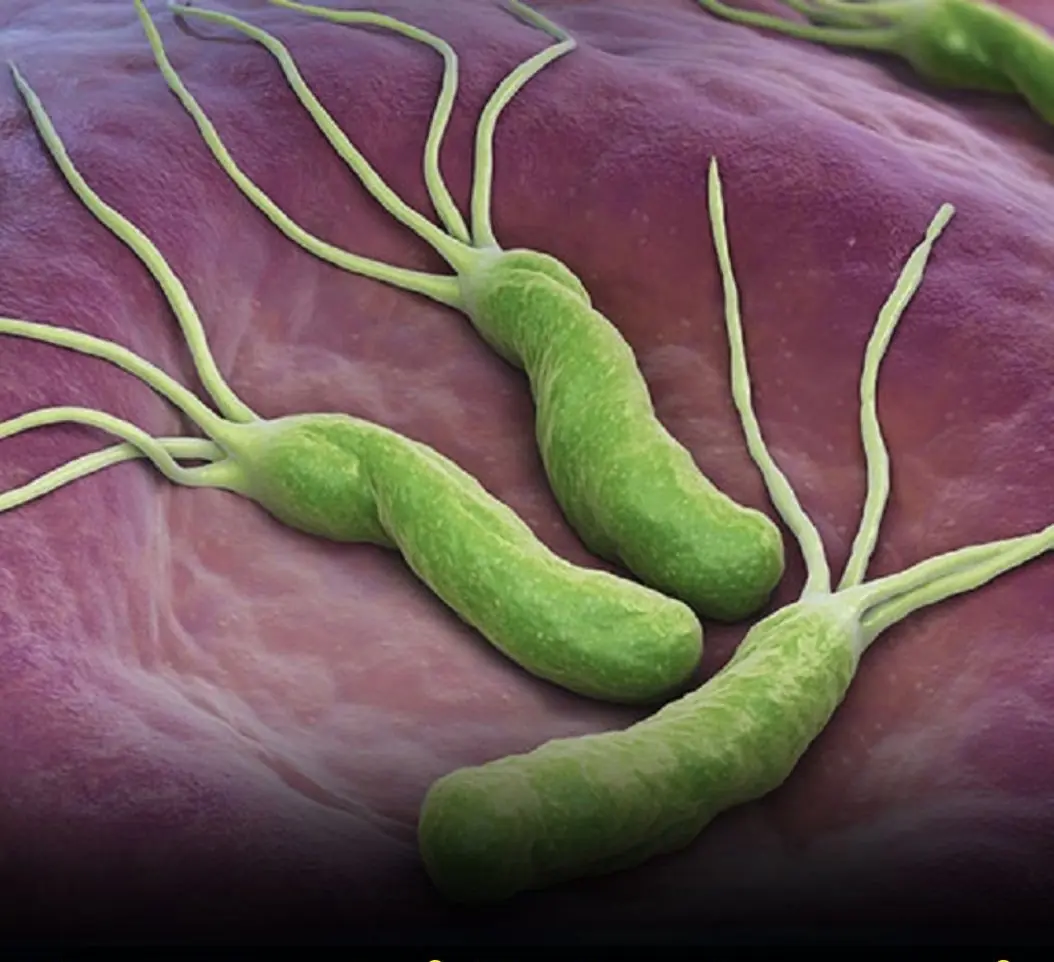 How to Treat H. Pylori (Helicobacter Pylori) Naturally Without Antibiotics.....