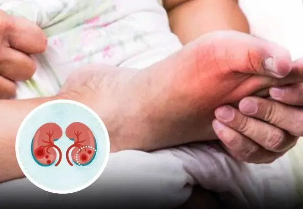 5 Odd Foot Symptoms That May Be Your Kid.neys’ Silent SOS