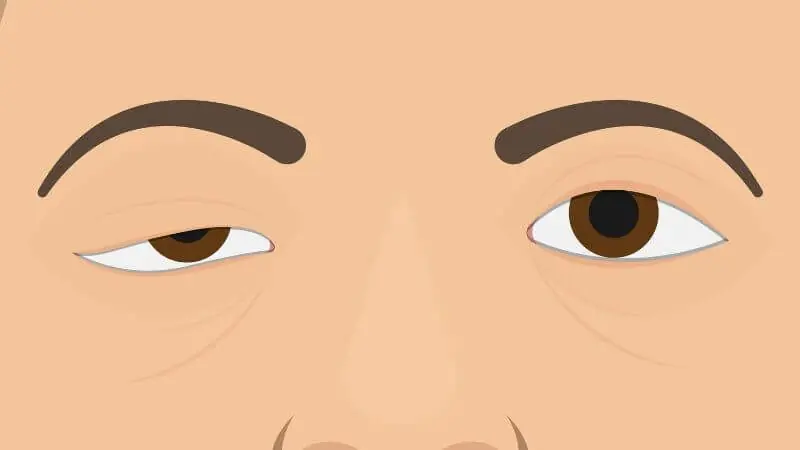 How can you identify myasthenia gravis, and what warning signs does it present?