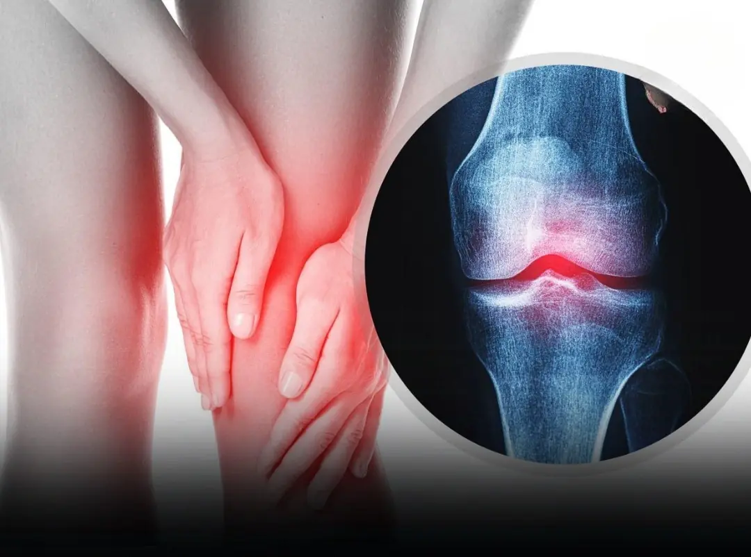 These 6 Common Foods Slowly Strip Your Body of Calcium — Stop Eating Them Before Your Bones Suffer!