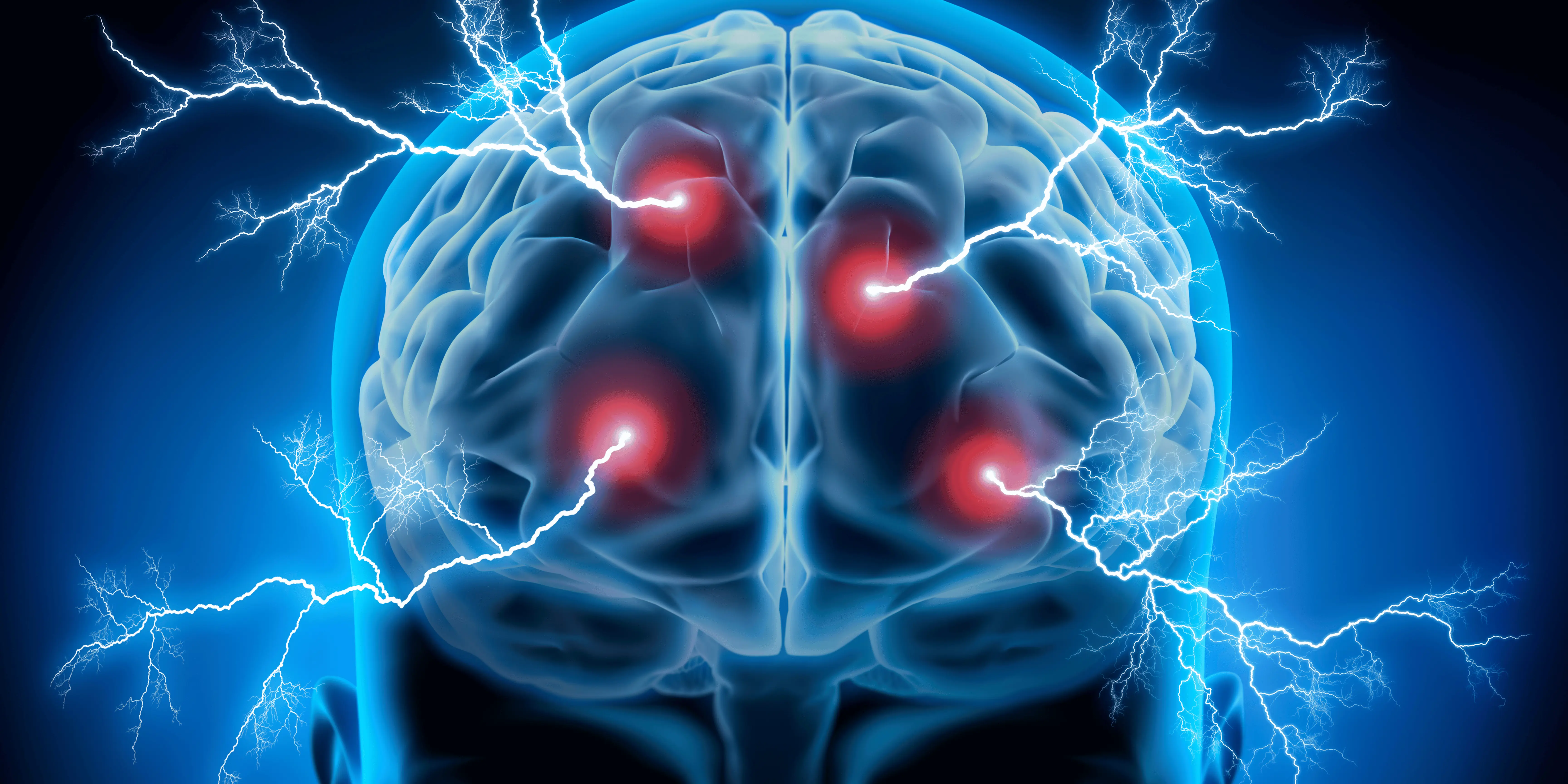 4 Nuts That May Harm Your Brain — And 4 That Help Protect It From Dementia