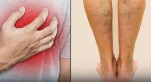 Don’t Dismiss These 5 Symptoms — They Could Signal a Future Heart Attack