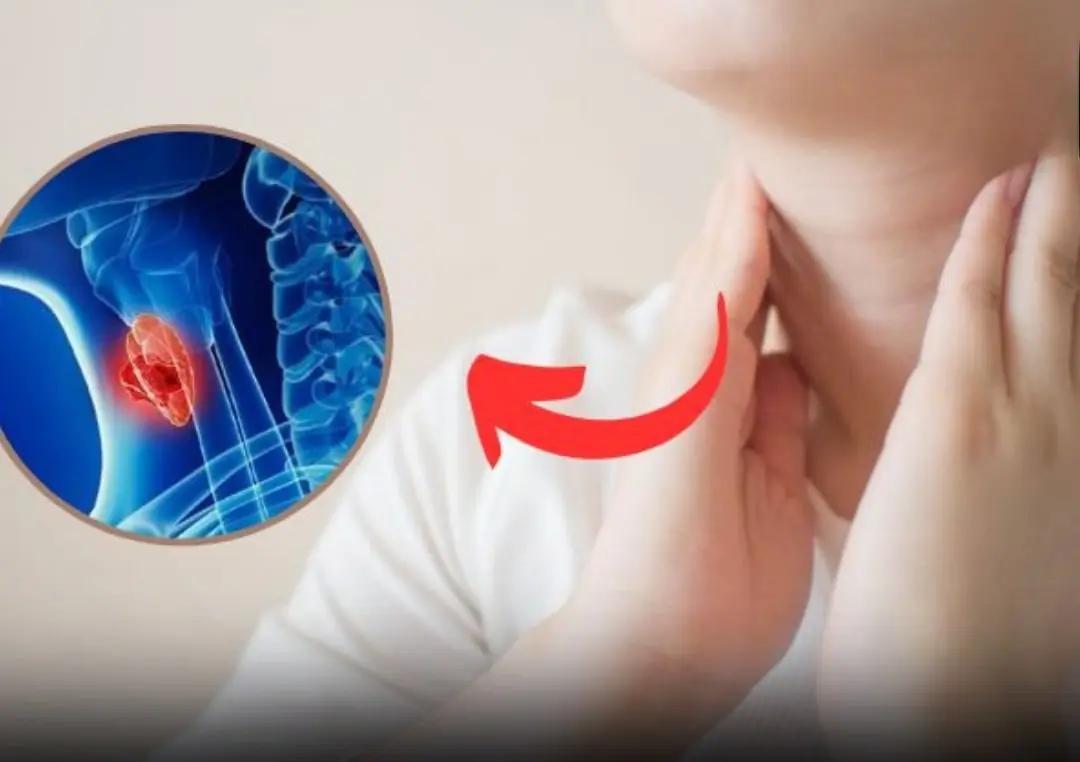 Don’t overlook the early signs of nasopharyngeal can:cer — survival can be as high as 72%