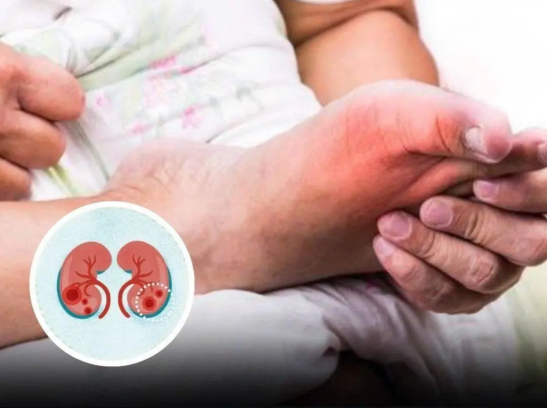 5 Odd Foot Symptoms That May Be Your Kid.neys’ Silent SOS