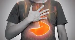 Is Your Heartburn a Sign of a Serious Condition?