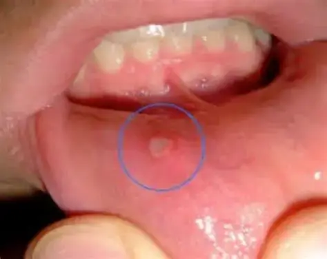 Early Symptoms You Shouldn’t Ignore: What Your Body May Be Telling You