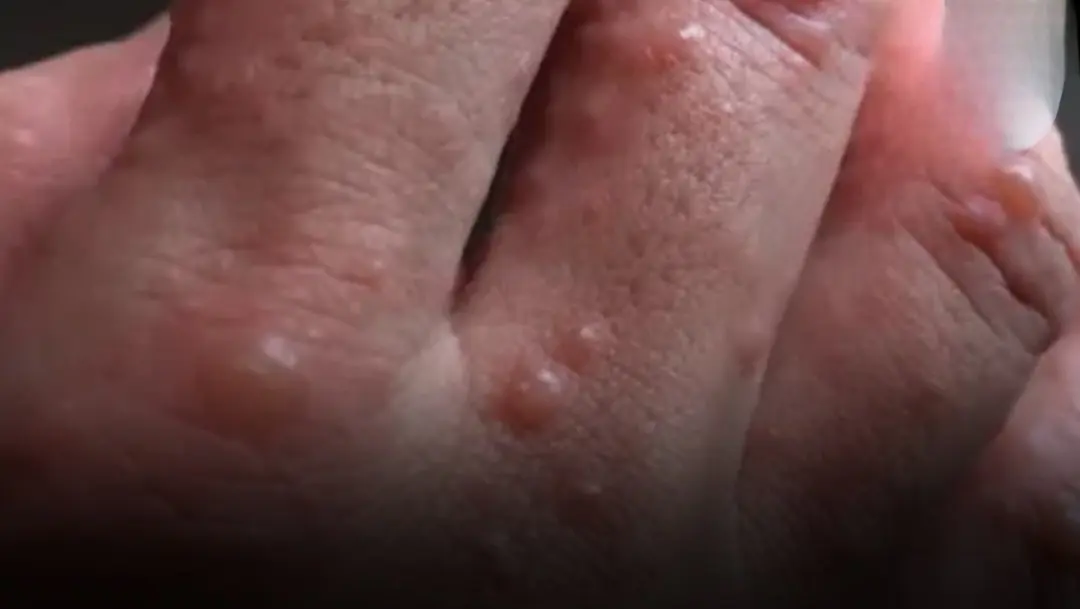 Doctors warn: if you have these tiny red dots on your arm or hand, do not ignore the warning signs