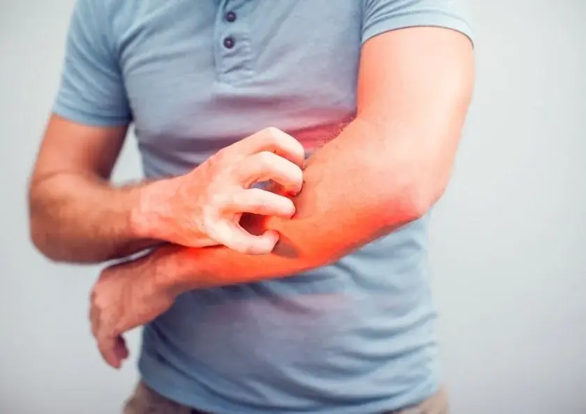 Unusual Itching and Skin Changes? It Could Be a Red Flag