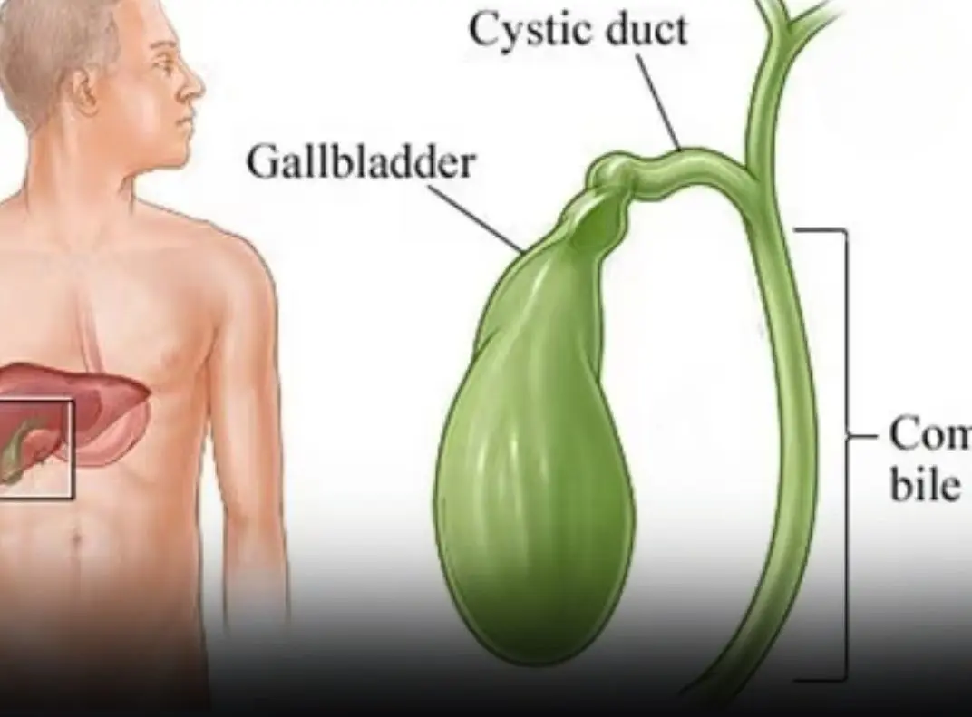 6 Subtle Symptoms That Could Signal Gallbladder Can:cer