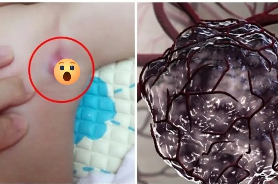 These 9 early signs in children are often ignored — but doctors warn they