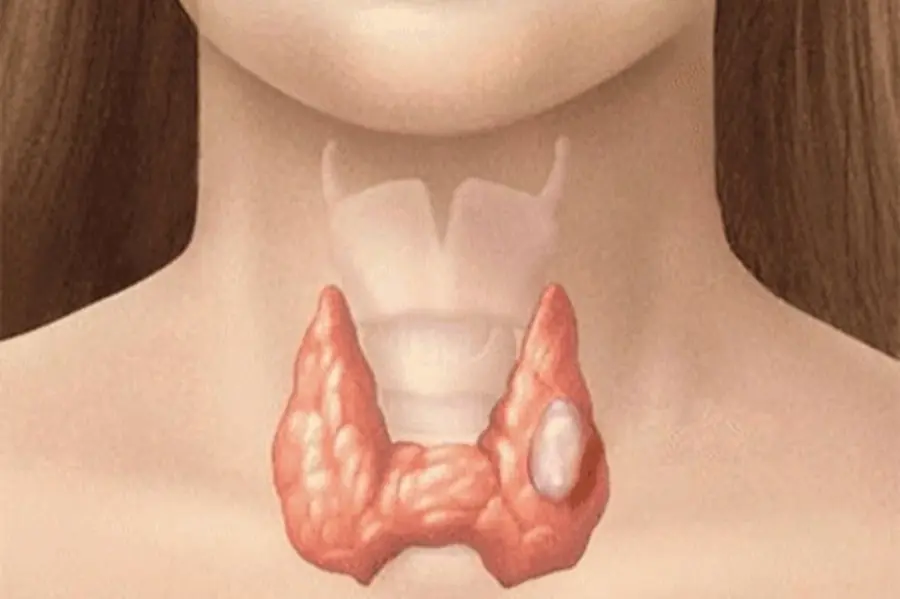 Experts warn that too much of this food may negatively affect thyroid health
