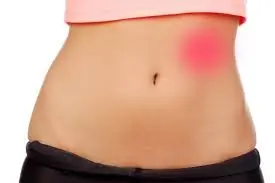 Experiencing Pain Under Your Left Rib Cage? Here’s What You Need to Know – See the Link Below