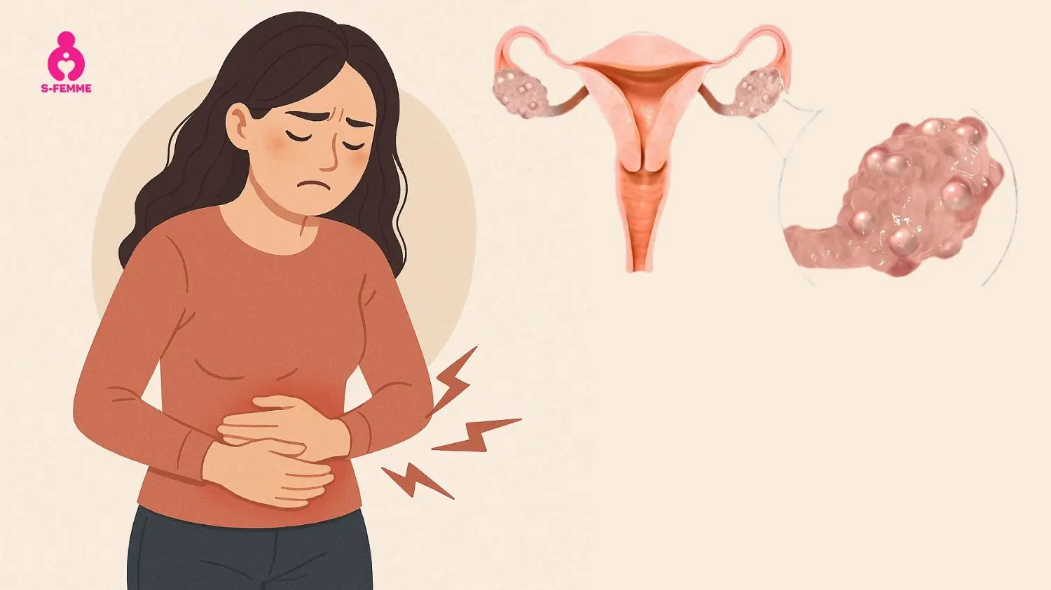 Could These 8 Symptoms Signal Ovarian Cancer? What to Know