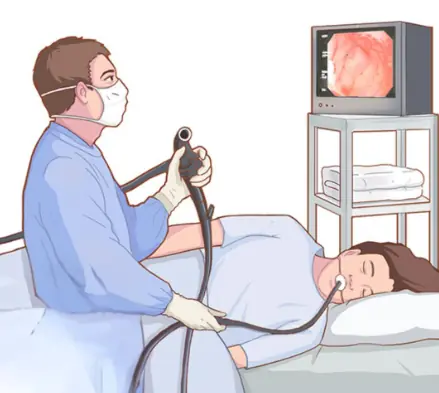 Colonoscopy: The key question you should ask your doctor before the procedure