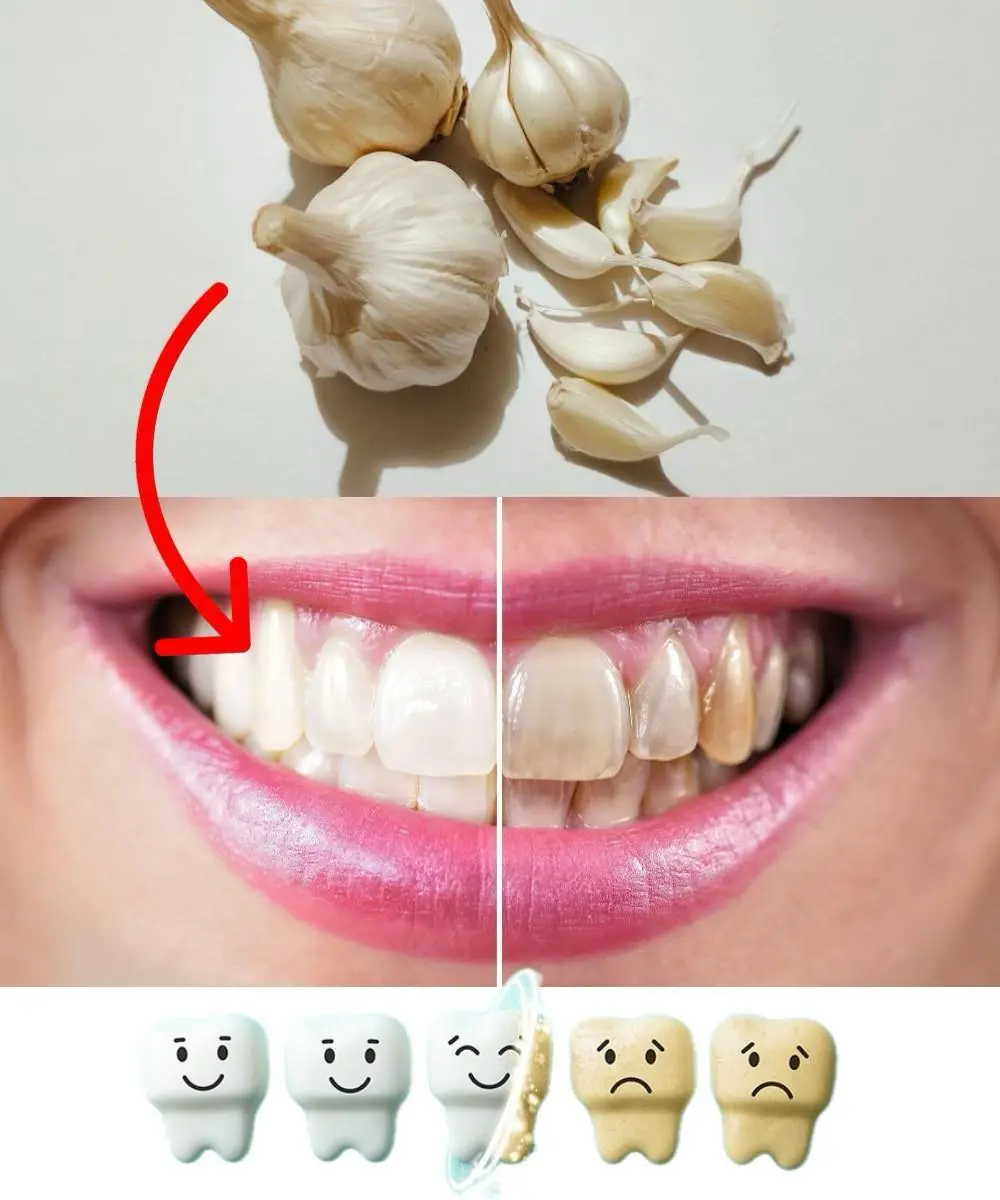 Dentists Will Hate That You Know This Trick: Remove Tartar and Whiten Teeth at Home Fast