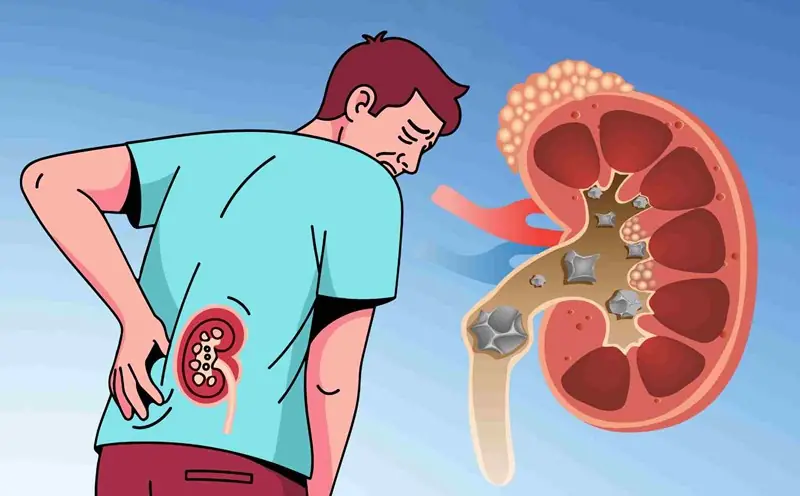 5 signs your kidneys may not be functioning properly - seek medical care promptly