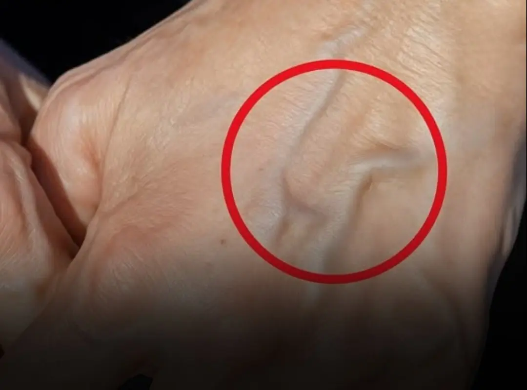 If you have visible veins, it means you are… See more