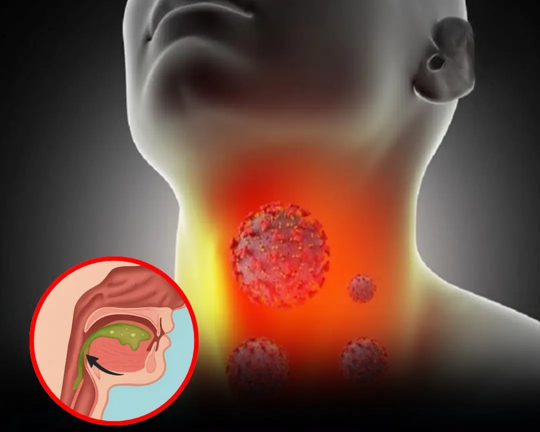 Why Your Throat Feels Mucusy and What It Could Mean
