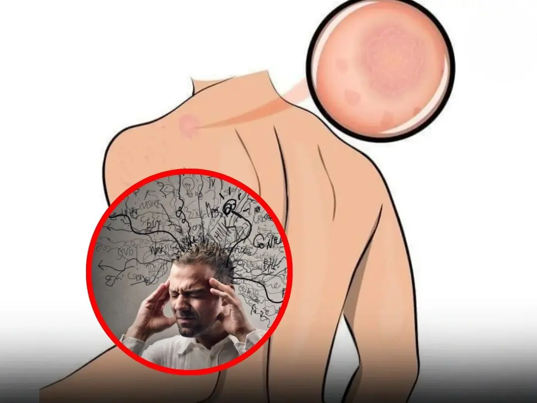 7 Warning Signals Your Body Sends When Stress Is Taking Over