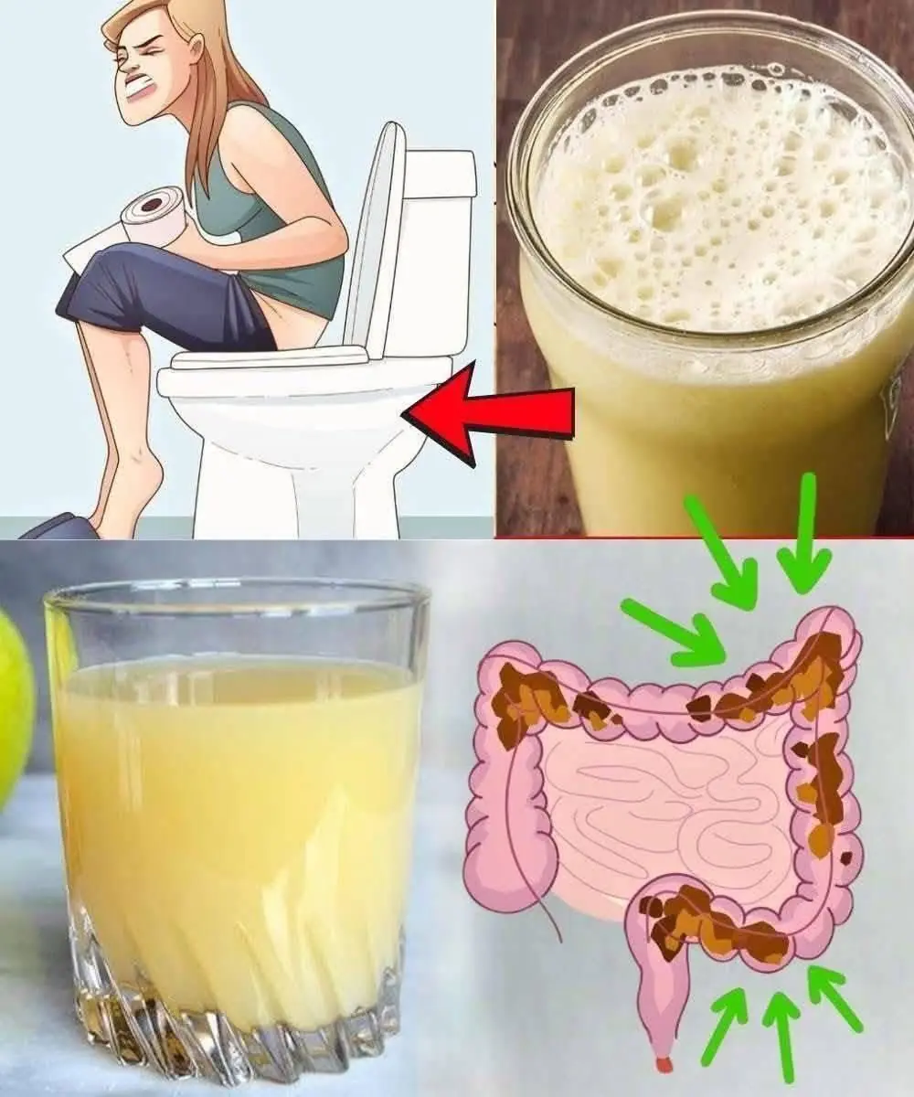 What You Should Know About Claims to Cleanse 15 kg of Waste From Your Colon in One Night