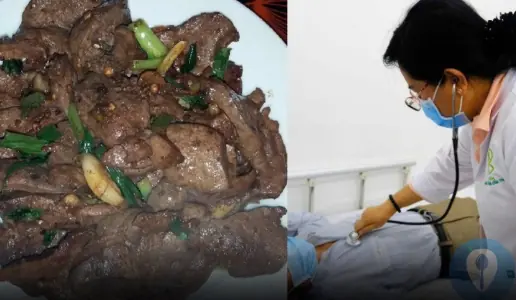 Doctors Share Why Certain Food Pairings May Raise Health Concerns