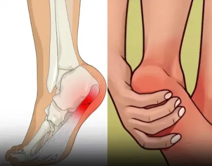 If Your Heel Hurts When You Wake Up or After Standing for a Long Time