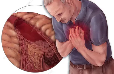 Midlife Health Alert: 10 Symptoms That May Signal Higher Stroke Risk