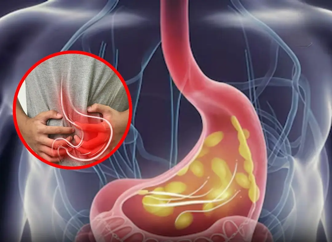 8 Warning Signs Your Stomach Disease Has Reached a Serious Stage