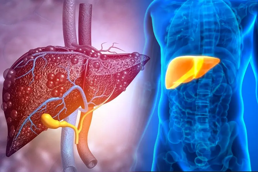 2 Warning Signs Your Liver May Be Failing — Don’t Ignore Them