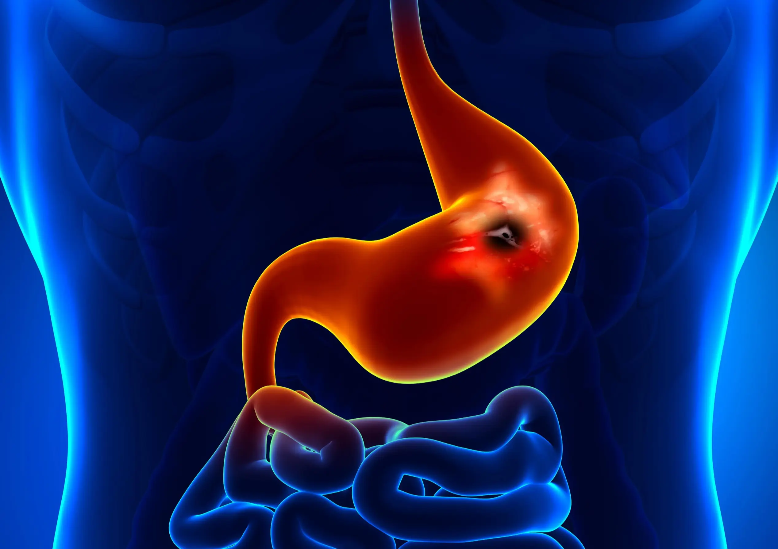 6 Subtle Symptoms of Stomach Cancer to Watch for Early