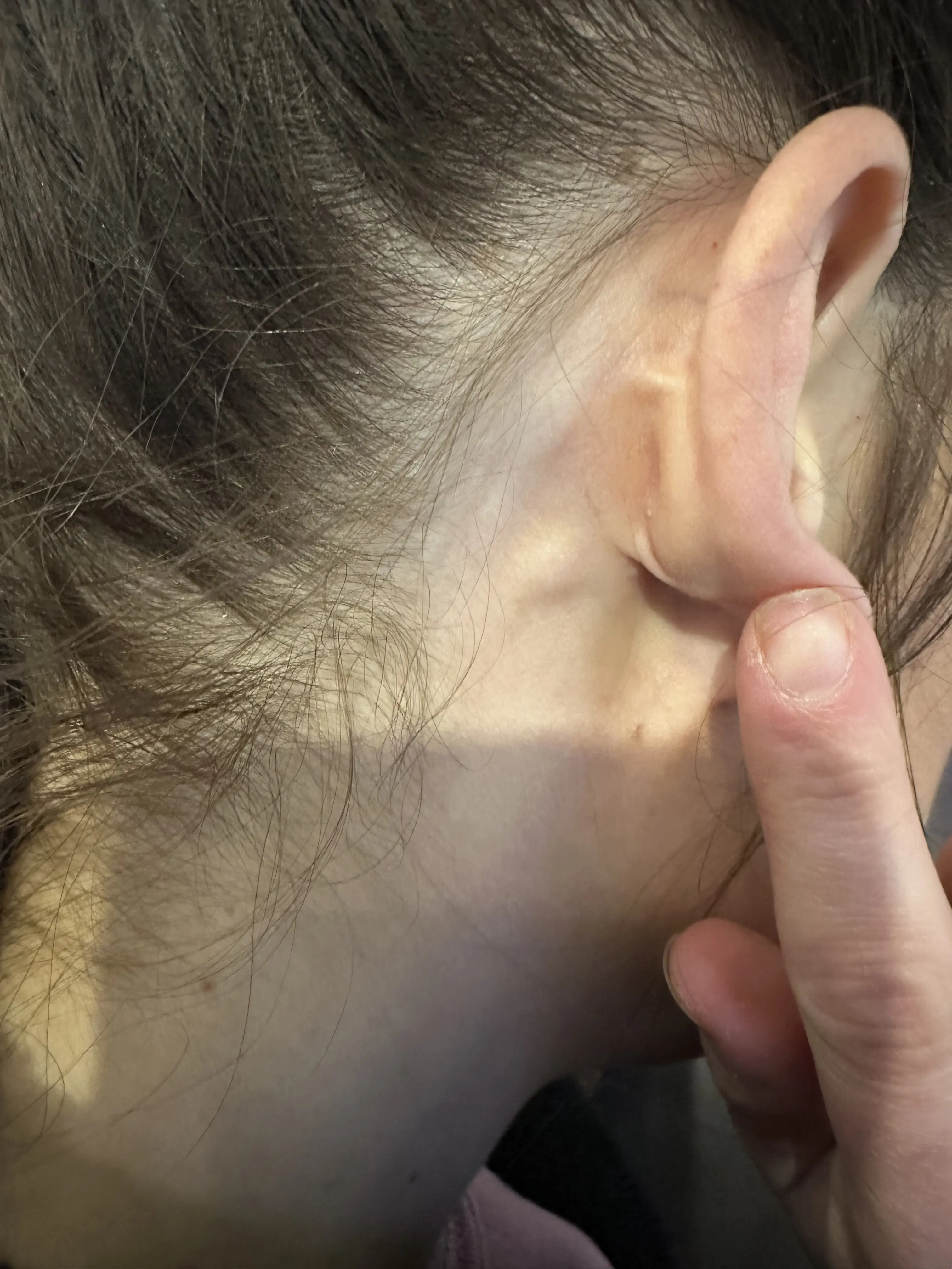 Itchy Ears? Beware of Juvenile Spring Eruption