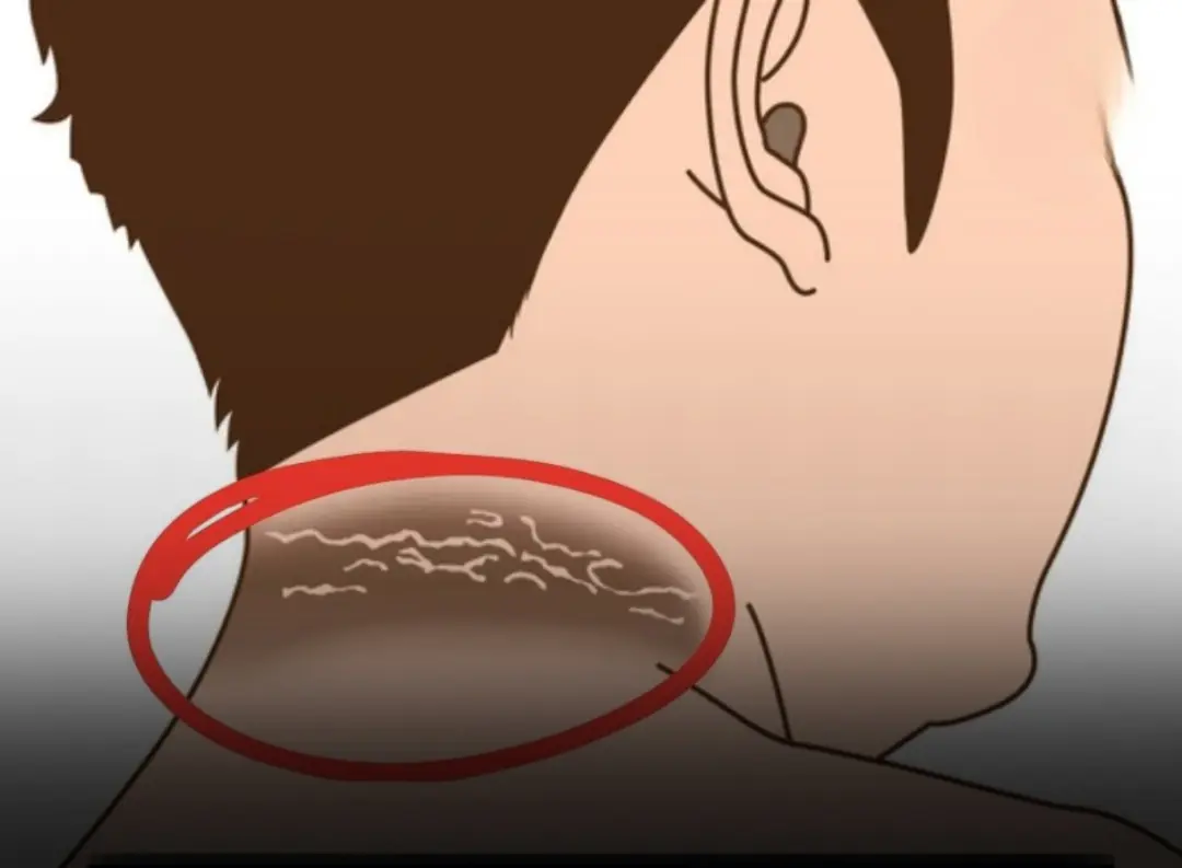 These 12 skin changes might look harmless — but they could be early clues of hidden diabetes...