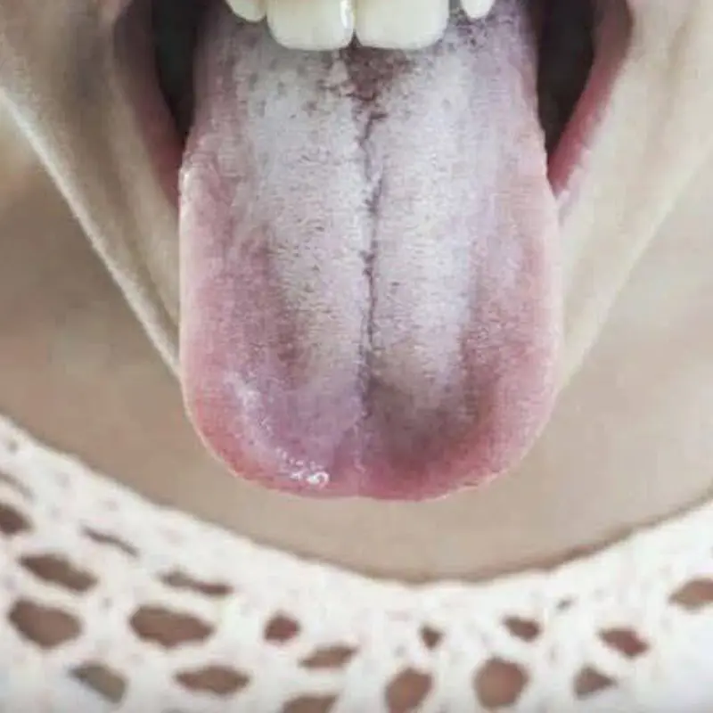 If your tongue is white, this is a clear sign that you are suffering from…see more