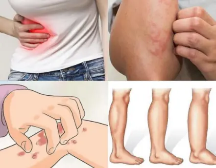 If Your Kidneys Are in Danger, Your Body Will Warn You With These 8 Signs