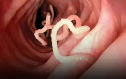 Don’t Ignore the First Sign — It Happens in Many Households